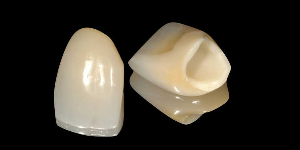 Coroas E Pontes Cer micas ORA Cl nica Medicina Dent ria