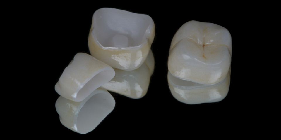 Coroas E Pontes Cer micas ORA Cl nica Medicina Dent ria